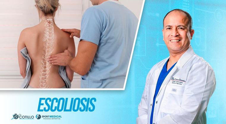 ¿Que es la escoliosis?, por el Dr. Cotillo